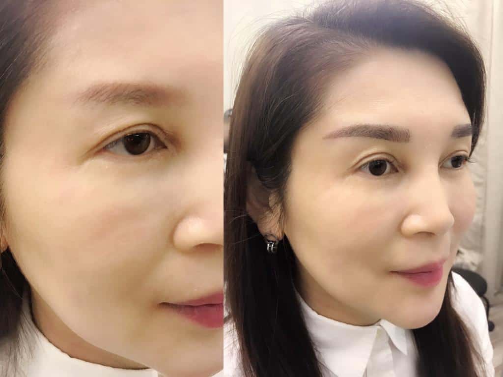 aileen-beauty-microblading-08